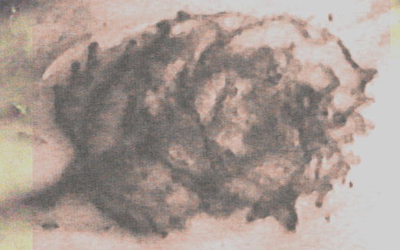 Image of Rose Tattoo on body of Jane Doe found in Simpson County